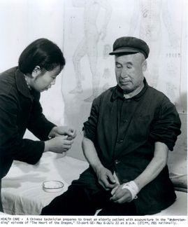 Trattamento con agopuntura in Cina